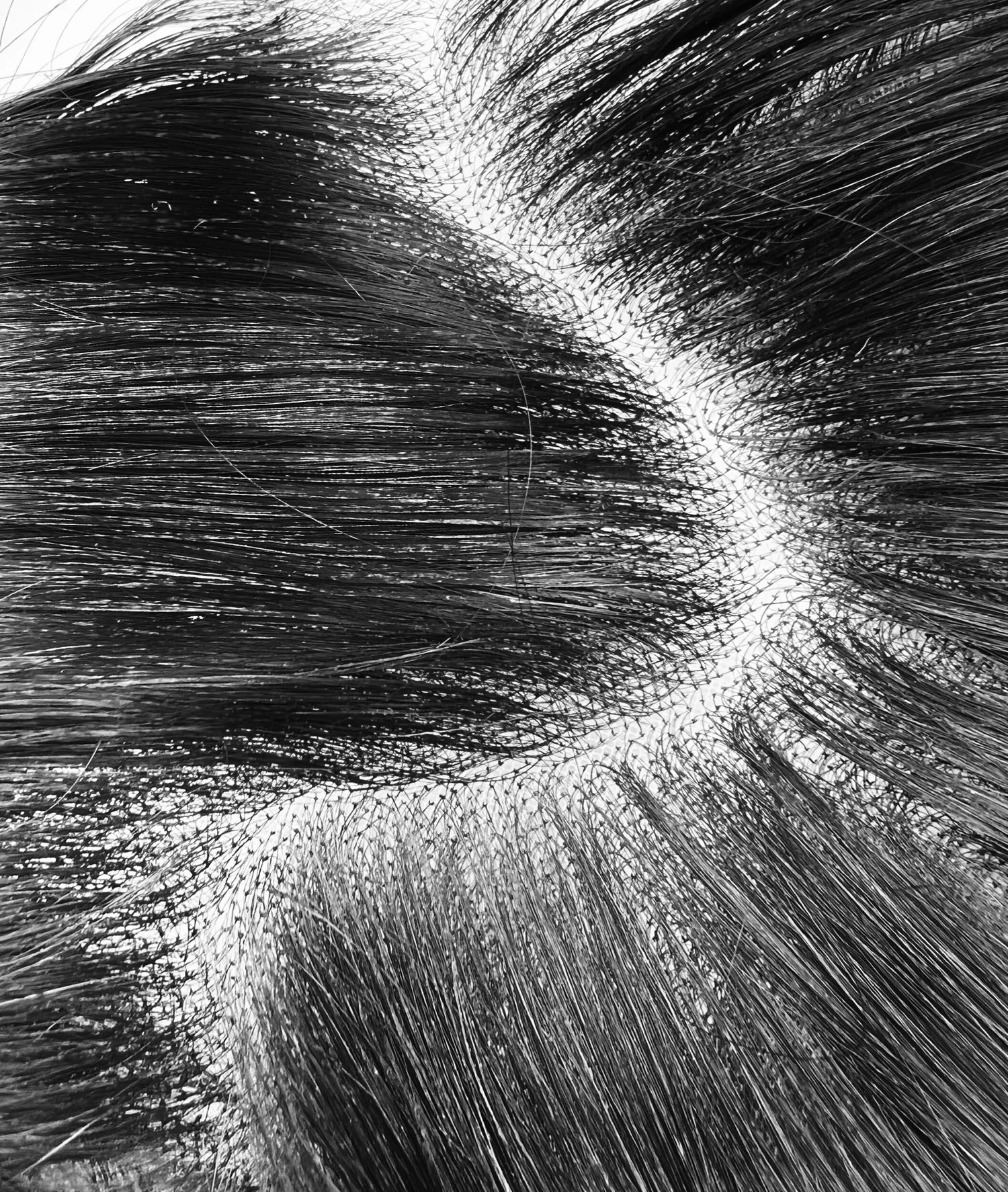 HD 5x5 Lace
